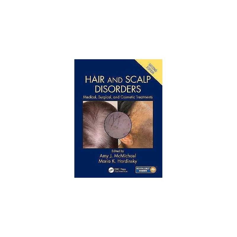 Hair and Scalp Disorders - 9781842145920
