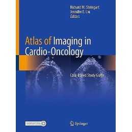 Atlas of Imaging in Cardio-Oncology - 9783030709976