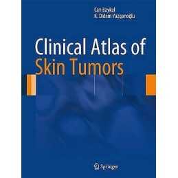 Clinical Atlas of Skin Tumors - 9783642409370