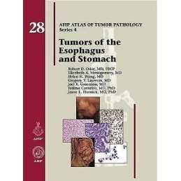 Tumors of the Esophagus and Stomach - 9781933477404