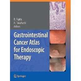 Gastrointestinal Cancer Atlas for Endoscopic Therapy - 9784431998600