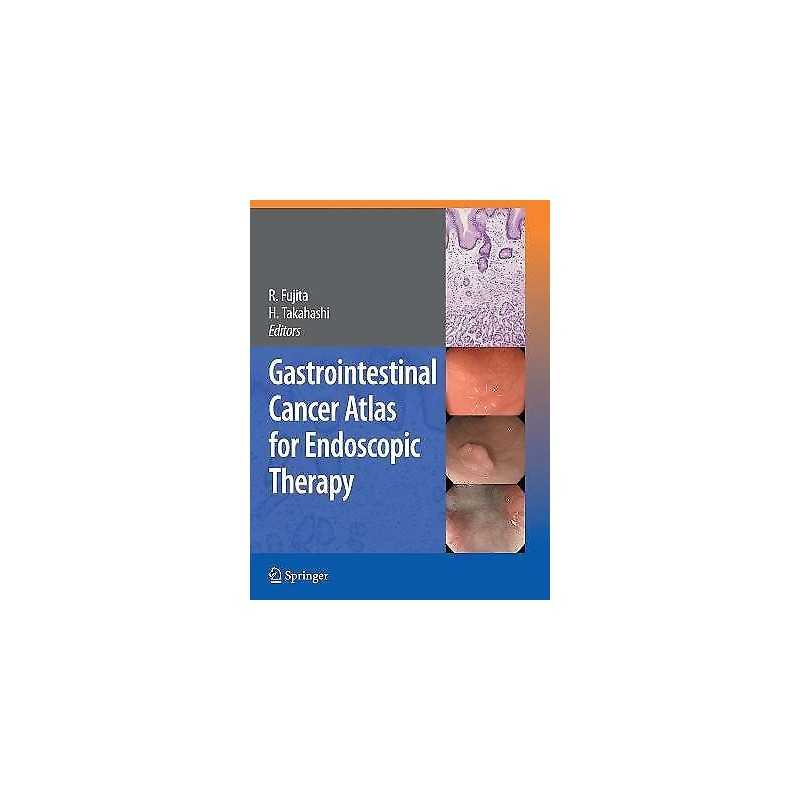 Gastrointestinal Cancer Atlas for Endoscopic Therapy - 9784431998600
