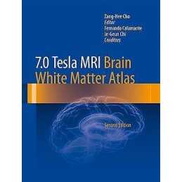 7.0 Tesla MRI Brain White Matter Atlas - 9783642543913