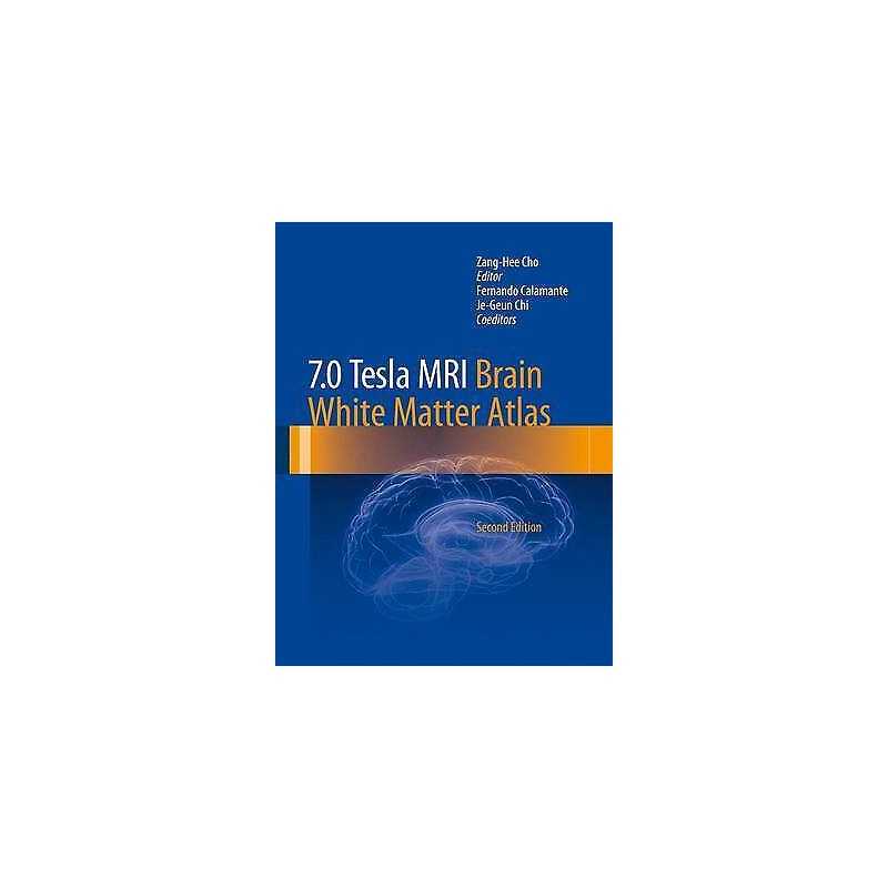 7.0 Tesla MRI Brain White Matter Atlas - 9783642543913