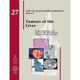 Tumors of the Liver - 9781933477411