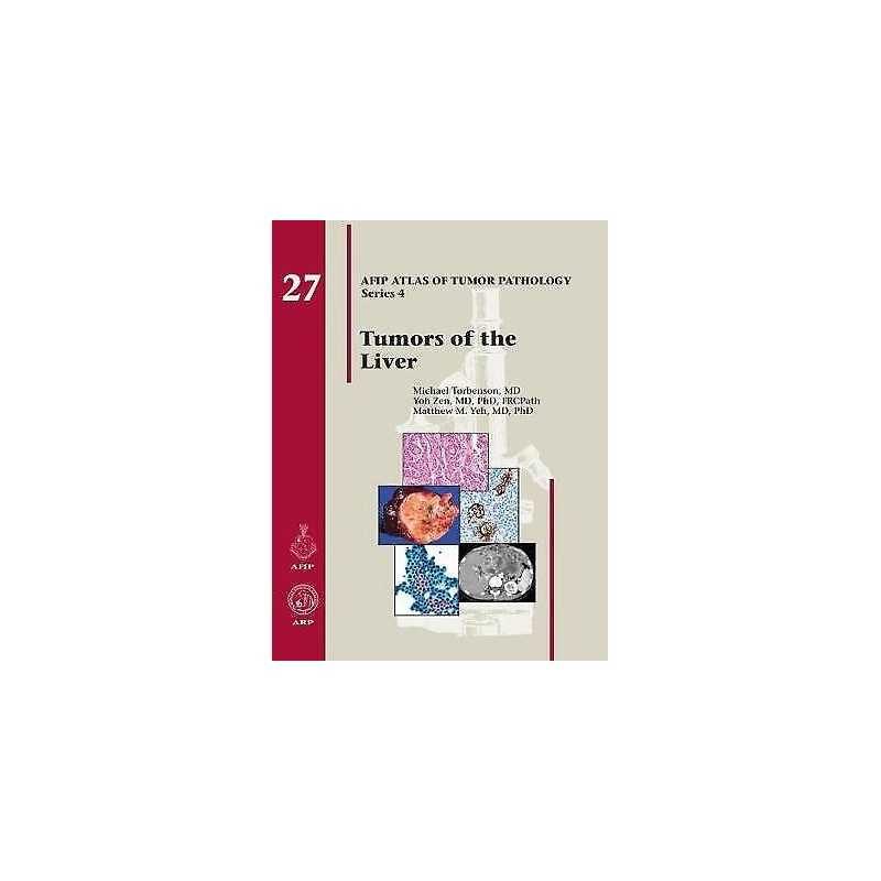 Tumors of the Liver - 9781933477411