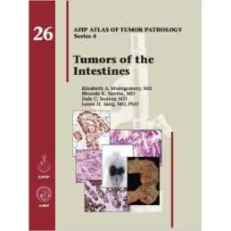 Tumors of the Intestines - 9781933477398