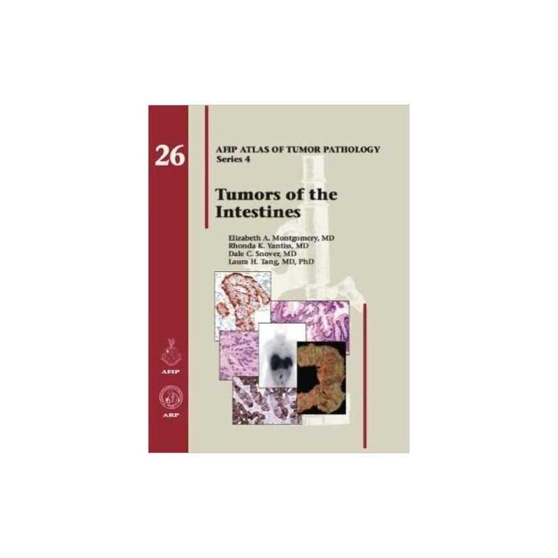 Tumors of the Intestines - 9781933477398