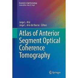 Atlas of Anterior Segment Optical Coherence Tomography - 9783030533731