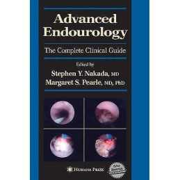 Advanced Endourology - 9781588294463