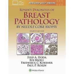 Rosens Diagnosis of Breast Pathology by Needle Core Biopsy - 9781496307255