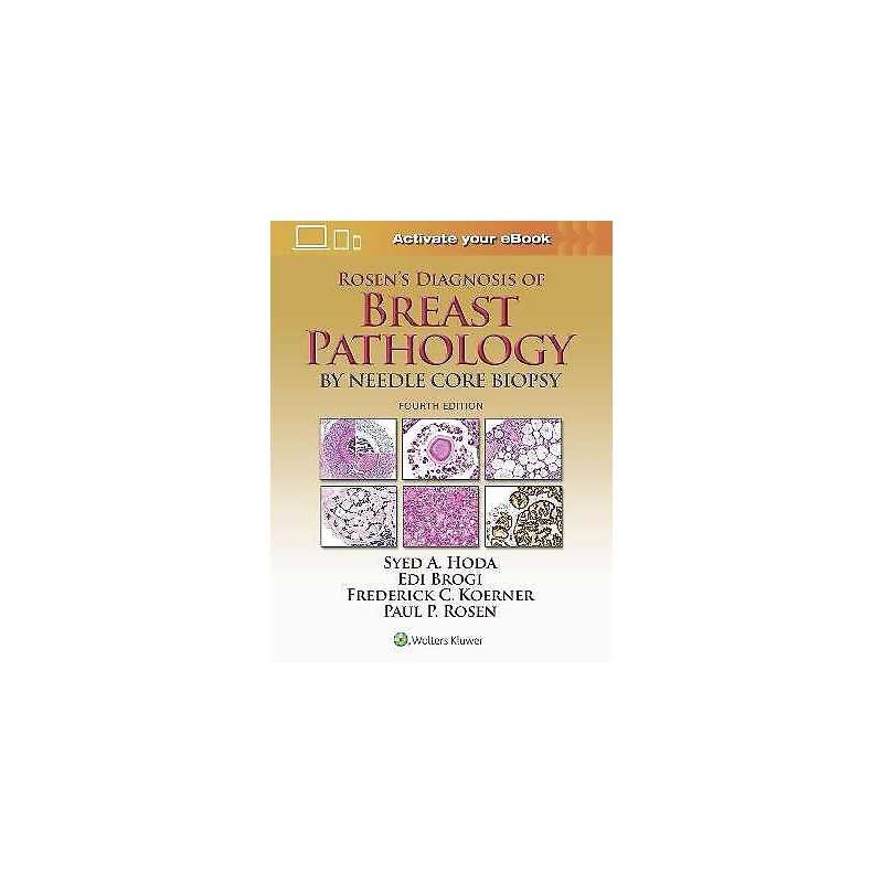 Rosens Diagnosis of Breast Pathology by Needle Core Biopsy - 9781496307255