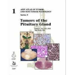 Tumors of the Pituitary Gland - 9781933477916