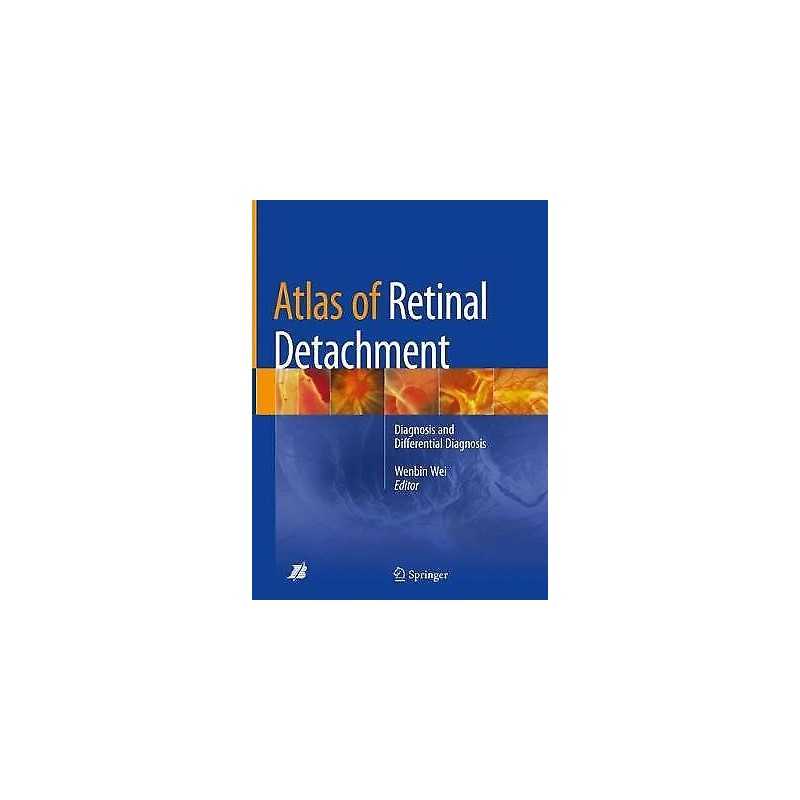 Atlas of Retinal Detachment - 9789811082306
