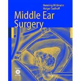 Middle Ear Surgery - 9783540222019