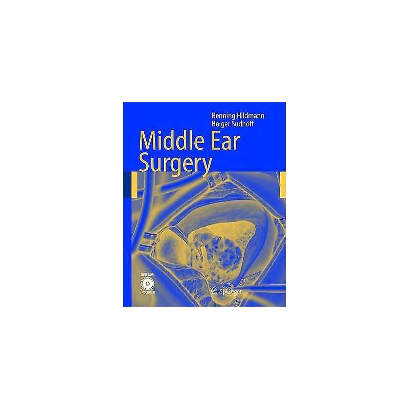 Middle Ear Surgery - 9783540222019