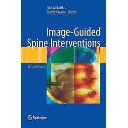 Image-Guided Spine Interventions - 9781441903518
