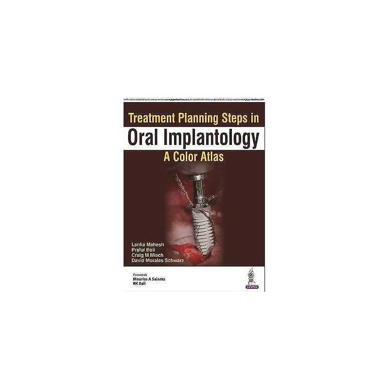 Treatment Planning Steps in Oral Implantology - 9789352700592