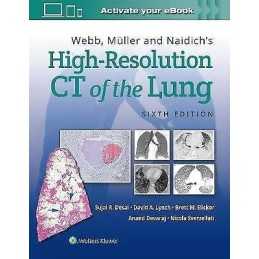 Webb, Muller and Naidichs High-Resolution CT of the Lung - 9781975144432