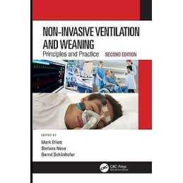 Non-Invasive Ventilation and Weaning - 9781498764766