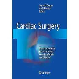 Cardiac Surgery - 9783662570685