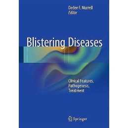 Blistering Diseases - 9783662456972
