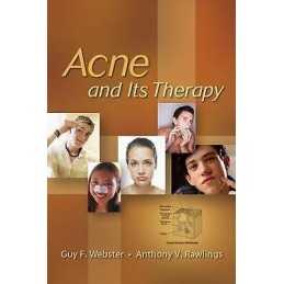 Acne and Its Therapy - 9780824729714
