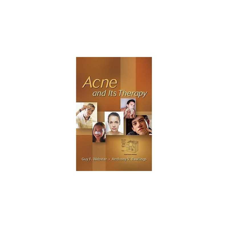Acne and Its Therapy - 9780824729714