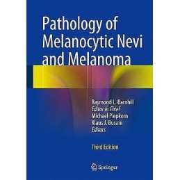 Pathology of Melanocytic Nevi and Melanoma - 9783642383847