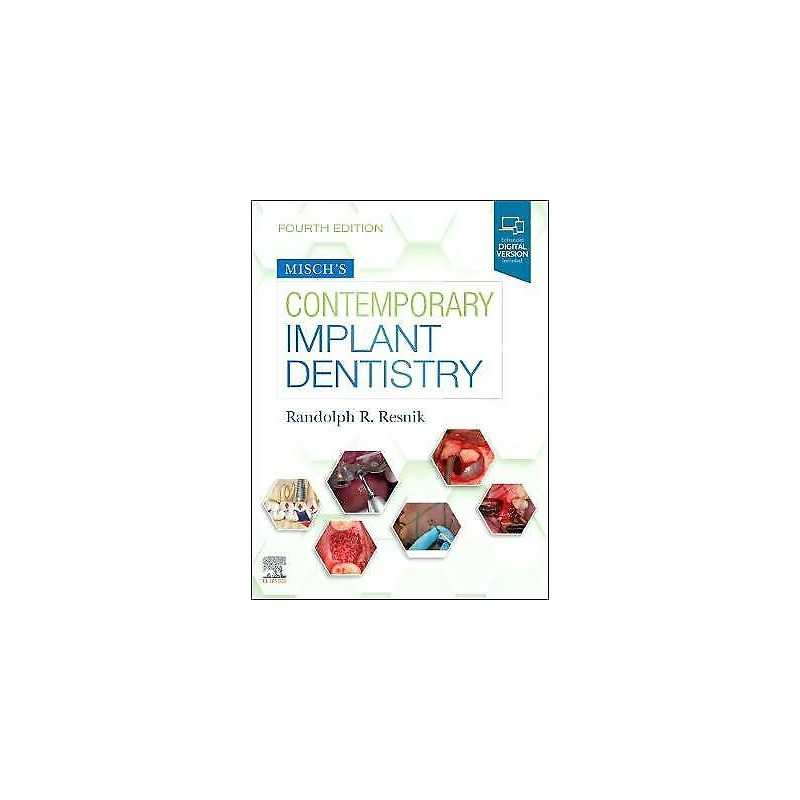 Mischs Contemporary Implant Dentistry - 9780323391559
