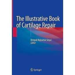 The Illustrative Book of Cartilage Repair - 9783030471538