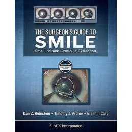 The Surgeons Guide to SMILE - 9781630912659