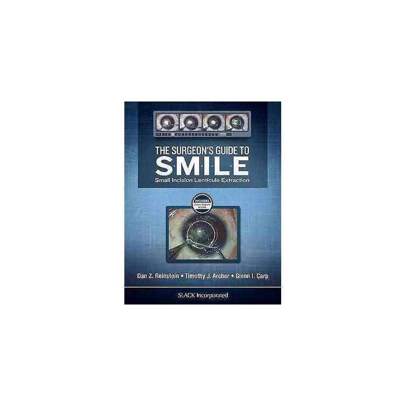 The Surgeons Guide to SMILE - 9781630912659