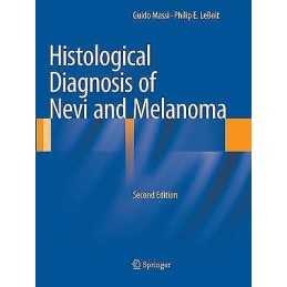 Histological Diagnosis of Nevi and Melanoma - 9783662500156