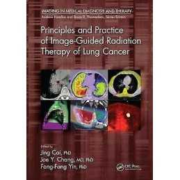 Principles and Practice of Image-Guided Radiation Therapy of ... - 9781498736732