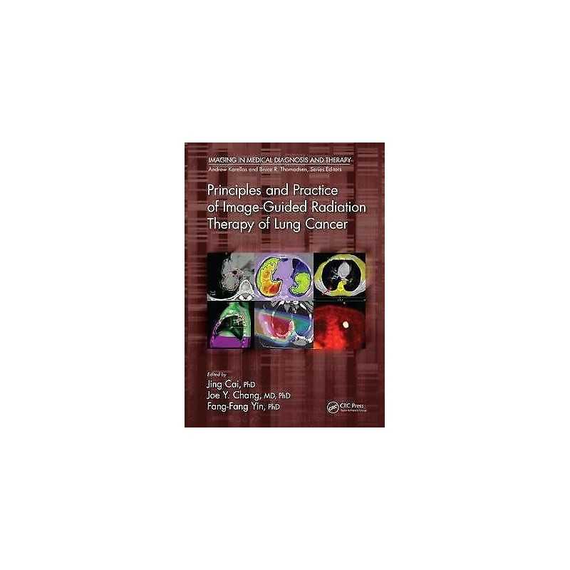 Principles and Practice of Image-Guided Radiation Therapy of ... - 9781498736732