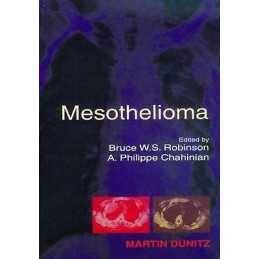Mesothelioma - 9789058231802