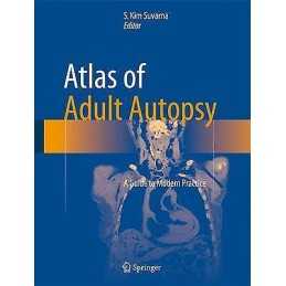 Atlas of Adult Autopsy - 9783319270203