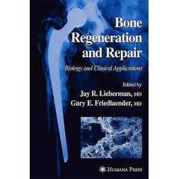 Bone Regeneration and Repair - 9781617372193