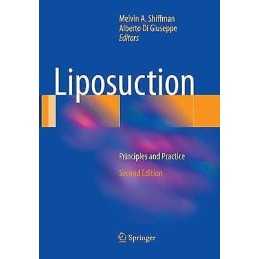 Liposuction - 9783662569627