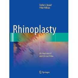 Rhinoplasty - 9783030097974