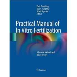 Practical Manual of In Vitro Fertilization - 9781493940646