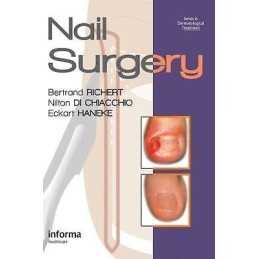 Nail Surgery - 9780415472333