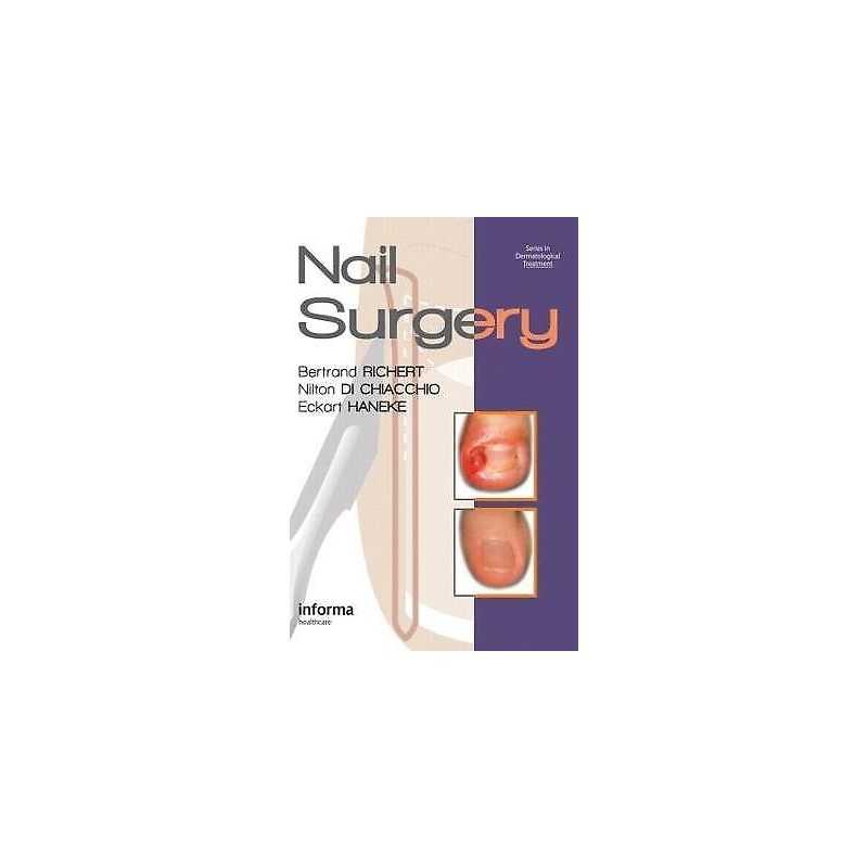 Nail Surgery - 9780415472333