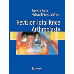 Revision Total Knee Arthroplasty - 9781441919748