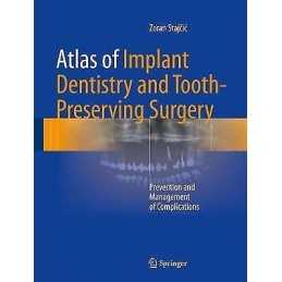 Atlas of Implant Dentistry and Tooth-Preserving Surgery - 9783319421223