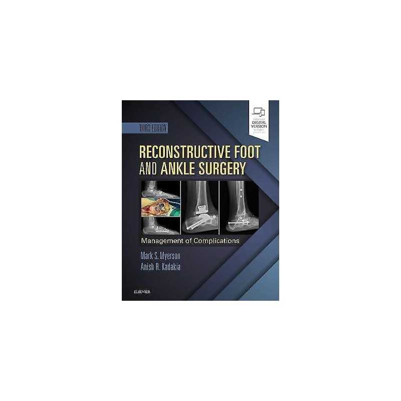 Reconstructive Foot and Ankle Surgery: Management of Complica... - 9780323496933