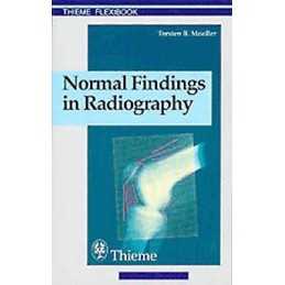 Normal Findings in Radiography - 9783131165312