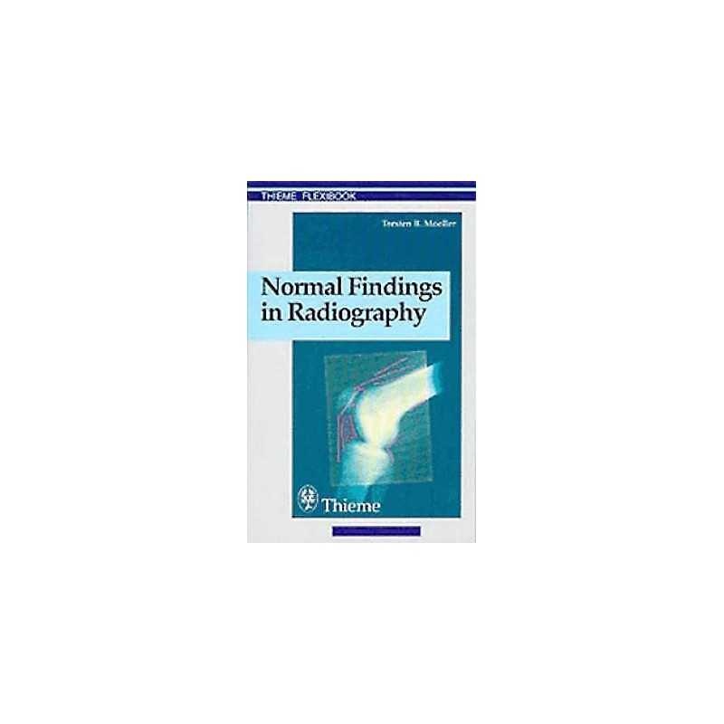 Normal Findings in Radiography - 9783131165312