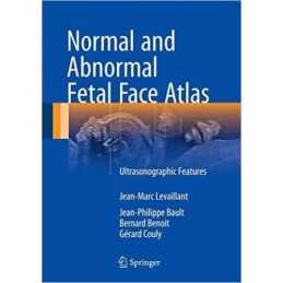 Normal and Abnormal Fetal Face Atlas - 9783319437682